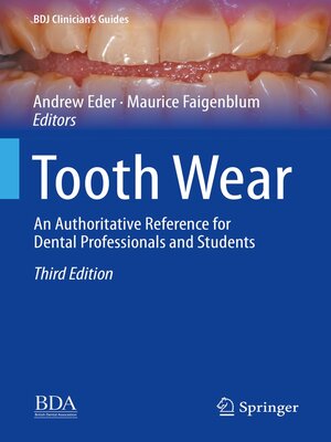 cover image of Tooth Wear